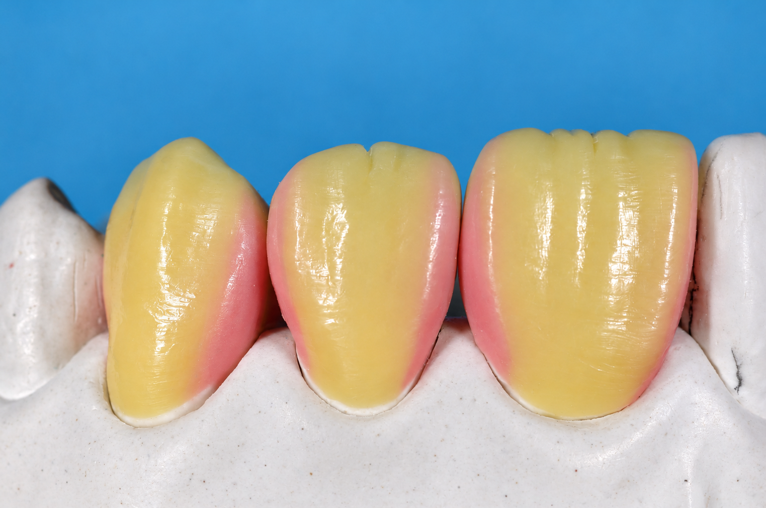 Anatomia e análise estética de dentes anteriores